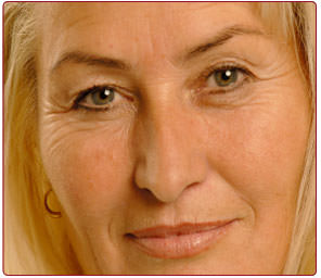 Retinol_and_Wrinkles