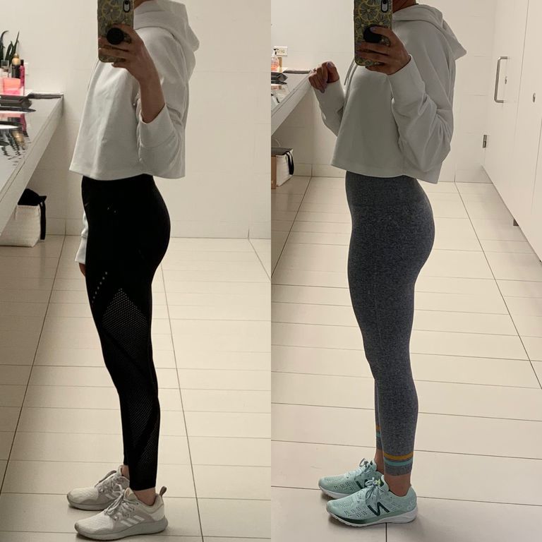 emsculpt results